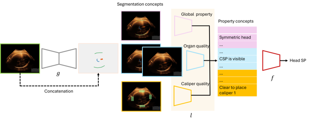 Progressive concept bottleneck model for fetal ultrasound quality assessment