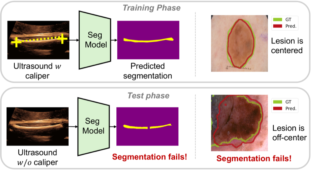 Clinical annotation and dataset construction shortcuts in medical segmentation